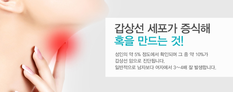 갑상선 세포가 증식해 혹을 만드는 것!